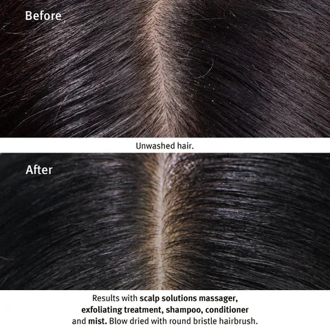 Before-and-after comparison of a scalp solution or haircare product, showing a close-up of dark hair parted down the center. The top labeled 'Before' shows an unruly, frizzy split, while the bottom labeled 'After' shows a smooth, cleanly parted scalp.