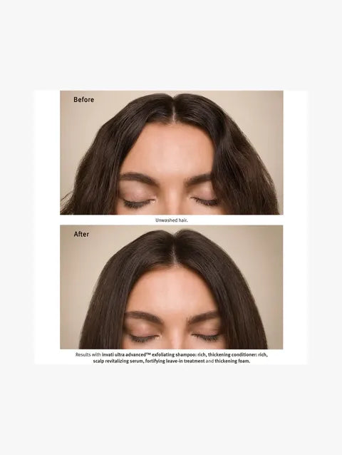 A before-and-after comparison showing a woman's hair treatment results. The top panel labeled 'Before' shows dry, frizzy hair, and the bottom panel labeled 'After' shows smoother, shinier, and thicker hair.