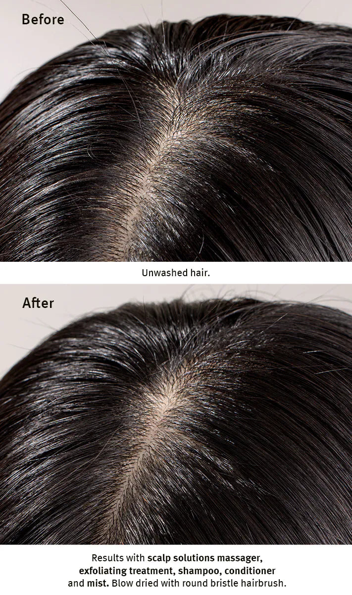 Comparison of unshampooed hair and cleaned scalp with text describing the process.