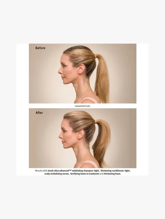 Before and after side profile comparison of a woman with long light brown hair in a ponytail, showing hair thickness and density improvement on a beige background with descriptive text below.
